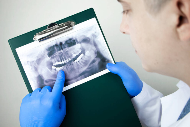Een tandarts onderzoekt een radiografie van de tanden van een patiënt die problemen heeft en tanden worden ingebracht. Het concept van onderzoek en diagnose - Foto, afbeelding