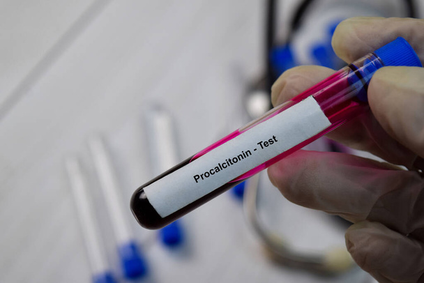 Procalcitonin Testtext mit Blutprobe. Draufsicht isoliert auf schwarzem Hintergrund. Gesundheitswesen / medizinisches Konzept - Foto, Bild