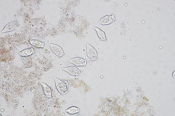 Living Vorticella is a genus of protozoan under microscop view.                                     - Photo, Image