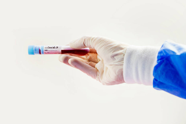 Corona virus blood test tubes on the white background, studio shoot. Blood test samples. Diagnosis and laboratory. - Photo, Image