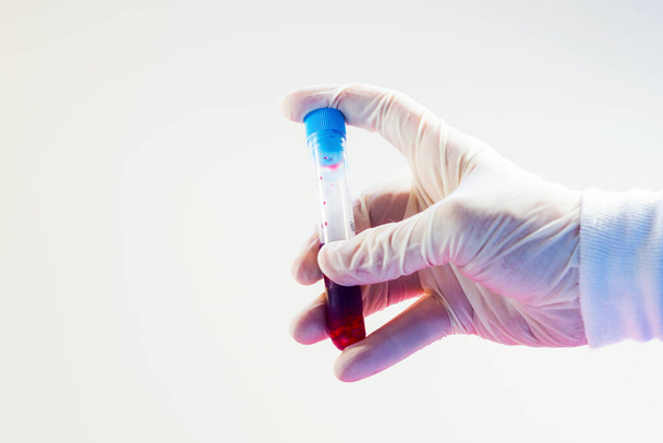 Tubos llenos de análisis de sangre en la mano del médico, sobre el fondo blanco, sesión de estudio
. - Foto, Imagen
