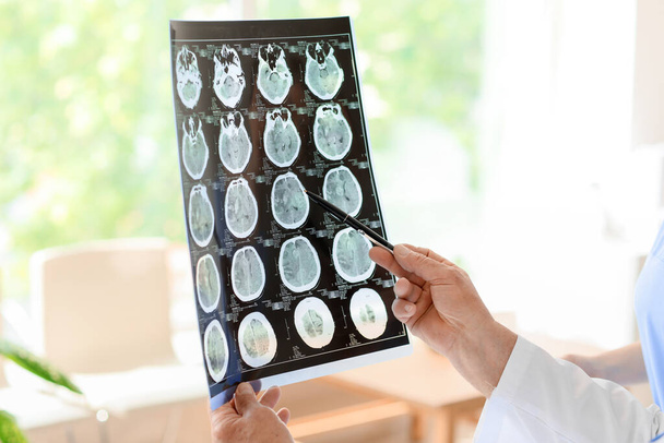 Senior neurologist with MRI scan of human head in clinic - Фото, изображение