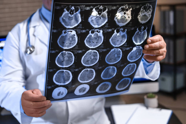 Senior neurologist with MRI scan of human head in clinic - Фото, изображение