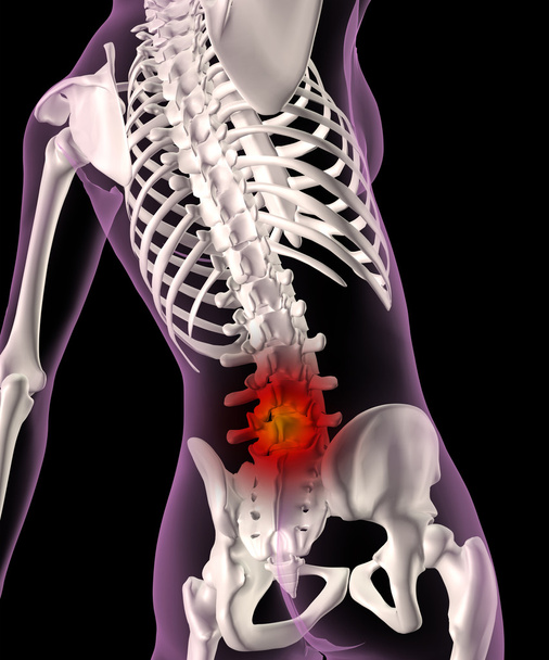Back ache in a female skeleton - Photo, Image