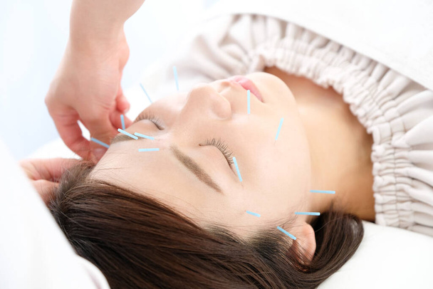 Up of a woman getting acupuncture on her face at an acupuncture clinic - Photo, Image