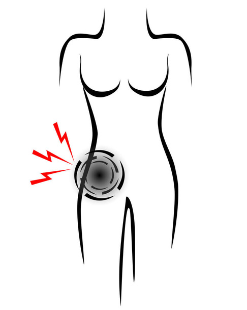 Corps féminin stylisé avec appendice point de douleur - Vecteur, image