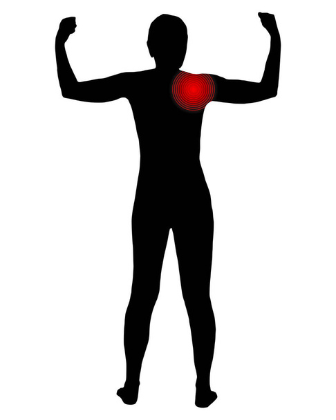 Rückenansicht einer Frau mit Symbol für Schulterschmerzen - Vektor, Bild