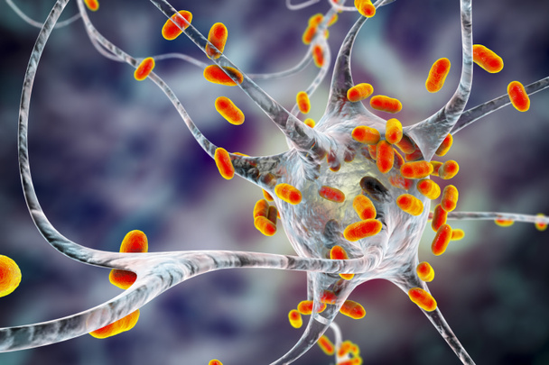 Bacteria infecting neuron, brain cell, 3D illustration. Conceptual illustration of bacterial encephalitis, meningitis, bacterial infection of brain tissue - Photo, Image