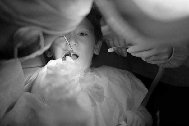 4 years old male child being cured in a dentist clinic - Fotografie, Obrázek