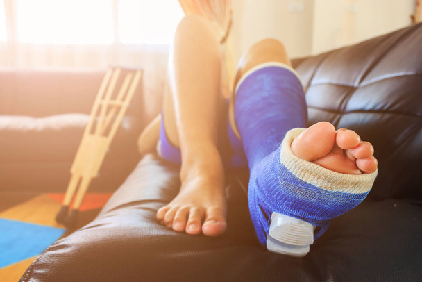 broken leg in a plaster cast with soft-focus in the background. over light - 写真・画像