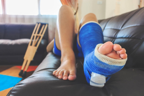 broken leg in a plaster cast with soft-focus in the background. over light - Photo, Image