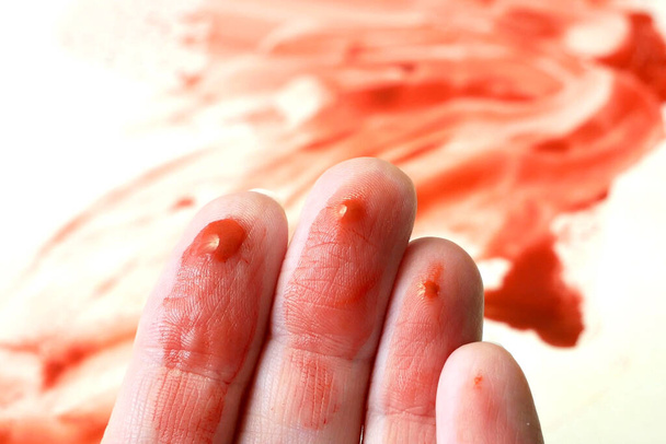 mãos no sangue e sangue em uma superfície branca no fundo - Foto, Imagem