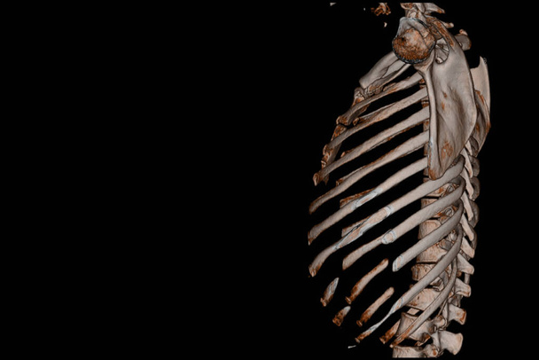 TC Scansione colonna vertebrale toracica 3D ritrovamento Il film ha mostrato lesioni da frattura toracica dopo l'altezza della forma di caduta, concetto di immagine medica. e sfondo nero. - Foto, immagini
