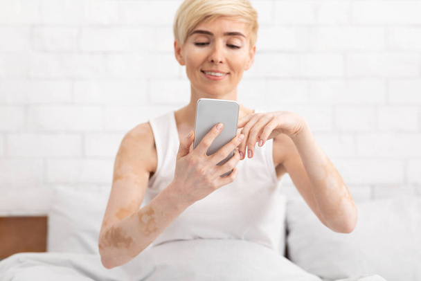Starší žena s vitiligo sítí na mobilním telefonu v posteli - Fotografie, Obrázek