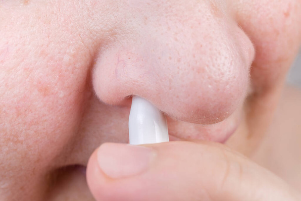 Fragment of human nose with nasal spray inserted into the nostril, close-up in selective focus - Foto, Imagem