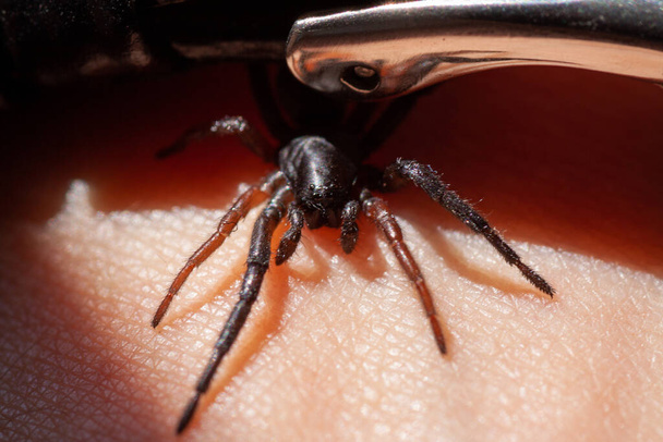 uma pequena aranha venenosa no braço
 - Foto, Imagem