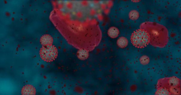 Hohe Konzentration Coronavirus Covid-19. Animationsgruppe von Viren und roten Blutkörperchen unter dem Mikroskop. 3D rendering 3D illustration - Foto, Bild