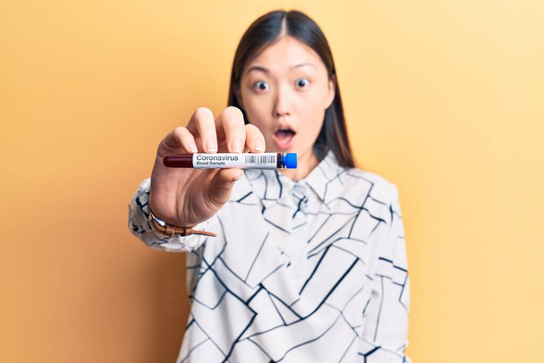 Joven hermosa mujer china sosteniendo tubo de prueba con coronavirus muestra de sangre asustado y sorprendido con la boca abierta para sorpresa, cara de incredulidad
  - Foto, Imagen
