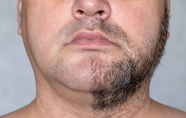 parte inferiore del volto dell'uomo. Metà del viso è rasato, l'altra metà con barba e baffi - Foto, immagini
