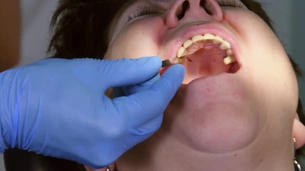 Старшая женщина получает зубной имплант - Кадры, видео