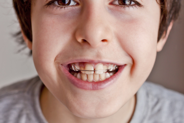 Happy teen with braces - Foto, immagini
