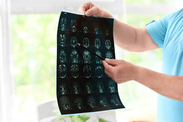 Senior neurologist with MRI scan of human head in clinic - Foto, Imagem