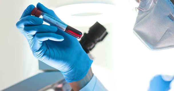 close up of microbiologist or medical worker hold blood test sample for the coronavirus covid-19 - Φωτογραφία, εικόνα