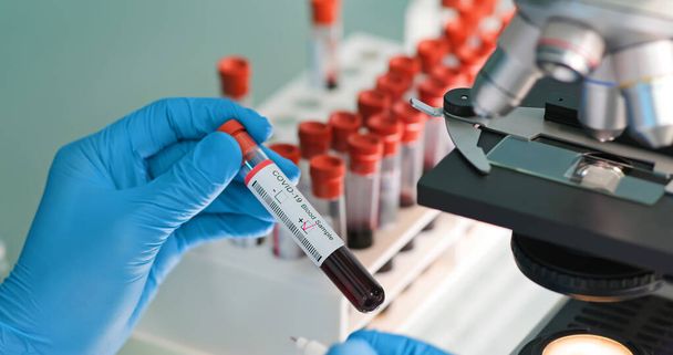 close up of microbiologist or medical worker take blood test result as positive for the coronavirus covid-19 - Fotografie, Obrázek