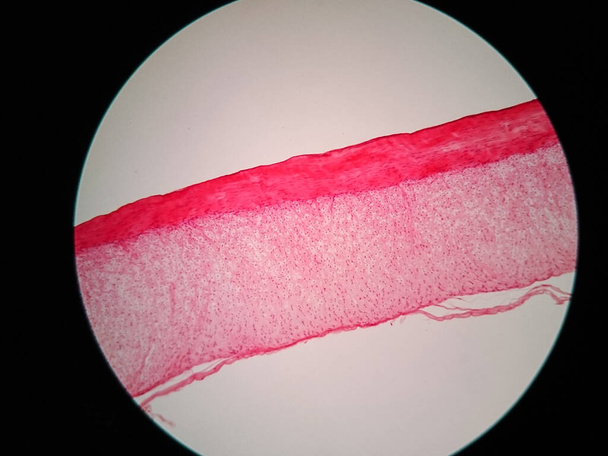 Sección transversal tendón humano bajo vista de microscopio
 - Foto, imagen