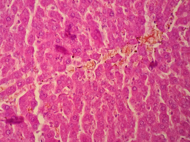 Tejido hepático humano bajo el microscopio ver
 - Foto, Imagen