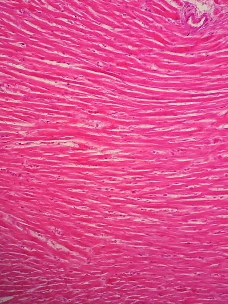 Histologia do músculo cardíaco humano sob visão microscópica
 - Foto, Imagem