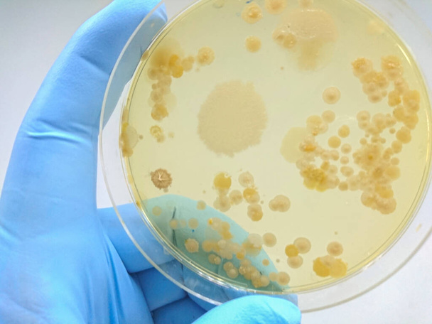 Colonia de bacterias en medio de cultivo, Microbiología. - Foto, Imagen