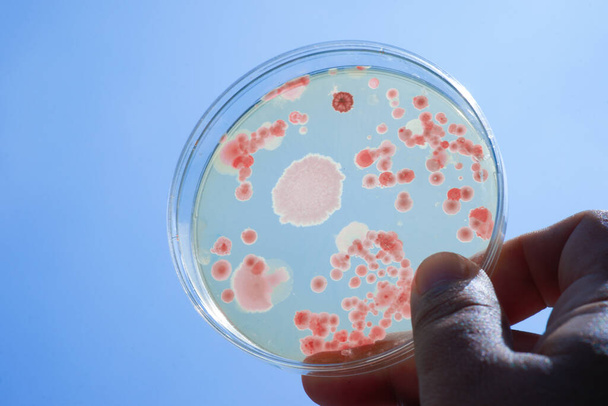 Colony of bacteria in culture medium plate, Microbiology. - Photo, Image