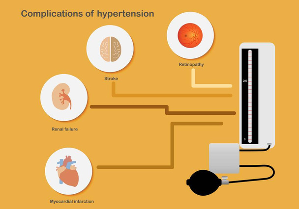 臓器に影響を及ぼす高血圧の合併症 - ベクター画像