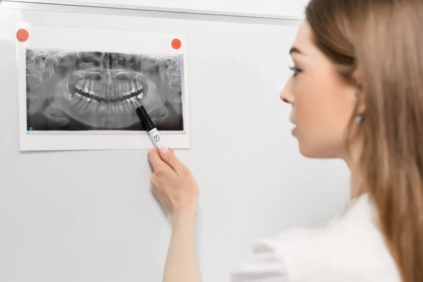 Giovane dentista donna medico in piedi di fronte a una tavola bianca esamina una foto a raggi X o scrive qualcosa - Foto, immagini
