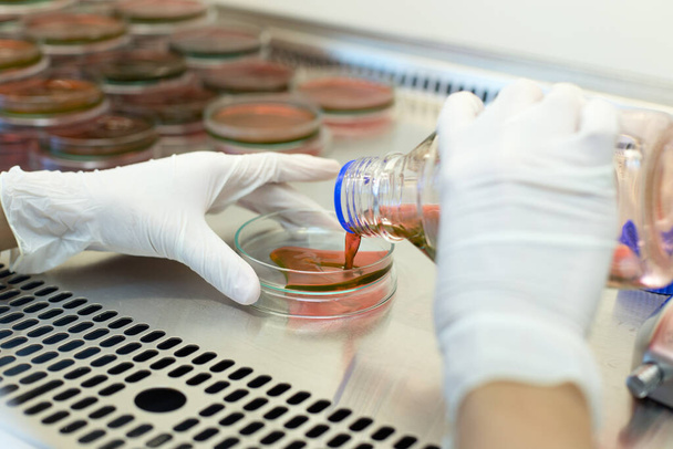 Eosin Methylene Blue (EMB) agar viljelynesteelle biologisten turvallisuuskaappien laboratoriossa tehtäviä Inoculum-testejä varten. - Valokuva, kuva