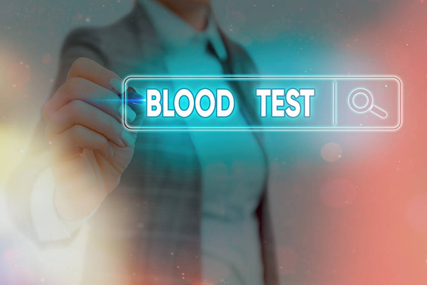 血液検査を示すメモを書く。研究室分析のために採取した血液サンプルを紹介するビジネス写真ウェブ検索デジタル情報未来技術ネットワーク - 写真・画像