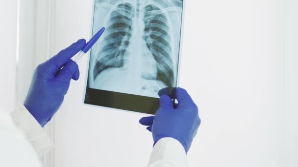 A medical worker,a doctor holds an x-ray in his hands,and makes a diagnosis,medical opinion,pneumonia and pulmonary edema - Felvétel, videó