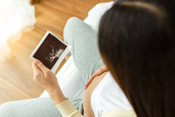 Έγκυος μητέρα Ασία αναζητούν υπερηχογράφημα ή υπερηχογράφημα φωτογραφία του εμβρύου μωρό. Όμορφη γυναίκα αγγίξει την κοιλιά της και να αισθάνονται την αγάπη ή να θαυμάσουν το μωρό ή το έμβρυο της τόσο πολύ. Η εγκυμοσύνη κάθεται στο κρεβάτι. επιλεκτική εστίαση - Φωτογραφία, εικόνα