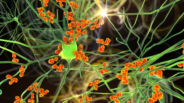 Anticuerpos atacando neuronas, ilustración 3D. Concepto de enfermedades neurológicas autoinmunes - Foto, imagen