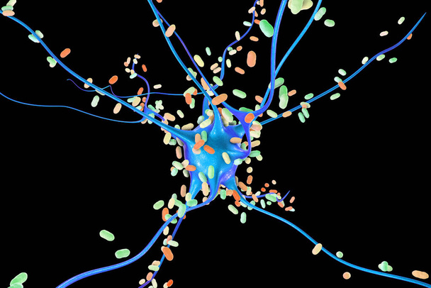 Βακτήρια που μολύνουν νευρώνα, εγκεφαλικά κύτταρα, τρισδιάστατη απεικόνιση. Εννοιολογική απεικόνιση βακτηριακής εγκεφαλίτιδας, μηνιγγίτιδας, βακτηριακής λοίμωξης του εγκεφαλικού ιστού - Φωτογραφία, εικόνα