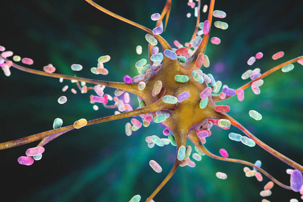 Βακτήρια που μολύνουν νευρώνα, εγκεφαλικά κύτταρα, τρισδιάστατη απεικόνιση. Εννοιολογική απεικόνιση βακτηριακής εγκεφαλίτιδας, μηνιγγίτιδας, βακτηριακής λοίμωξης του εγκεφαλικού ιστού - Φωτογραφία, εικόνα
