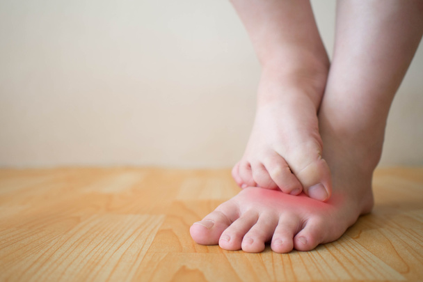 Jonge vrouw krabt de jeuk op haar voeten met roodheid uitslag. Oorzaak van jeukende huid omvatten voetschimmel (schimmelinfectie), dermatitis (eczeem), psoriasis, of insectenbeten. Gezondheidszorg. Kopieerruimte. - Foto, afbeelding
