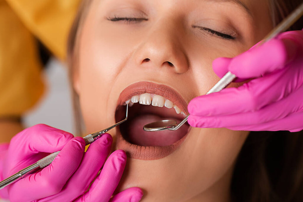 Jovens mulheres loiras bonitas no dentista, cuidados dentários
 - Foto, Imagem