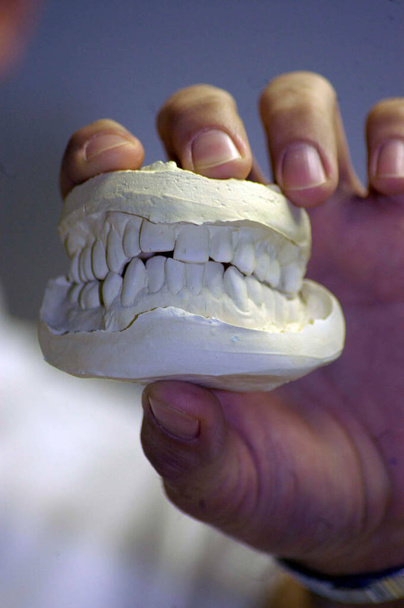 une empreinte dentaire de dents humaines au cabinet dentaire - Photo, image