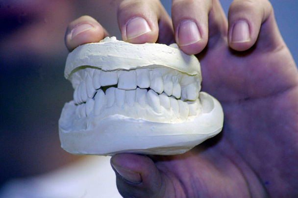 een tandheelkundige impressie van menselijke tanden op het tandartspraktijk - Foto, afbeelding