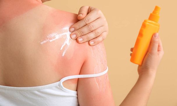 Woman with red sunburned skin applying cream against color background, closeup - Valokuva, kuva