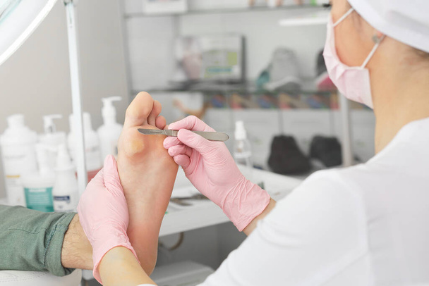 Professional pedicure using dieffenbach scalpel.Patient visiting podiatrist.Medical pedicure procedure using special instrument with blade knife holder.Foot treatment in SPA salon.Podiatry clinic - Φωτογραφία, εικόνα