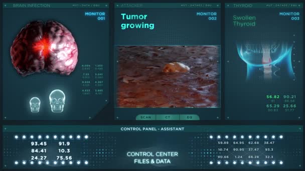 Tumor creciente HUD médica
 - Metraje, vídeo