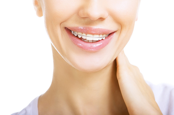 Beautiful smiling girl with retainer for teeth - Фото, зображення